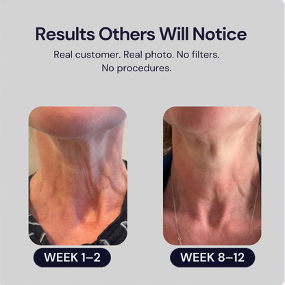 Reliefora™ Collagen Peptide Neck Lifting Ampoule