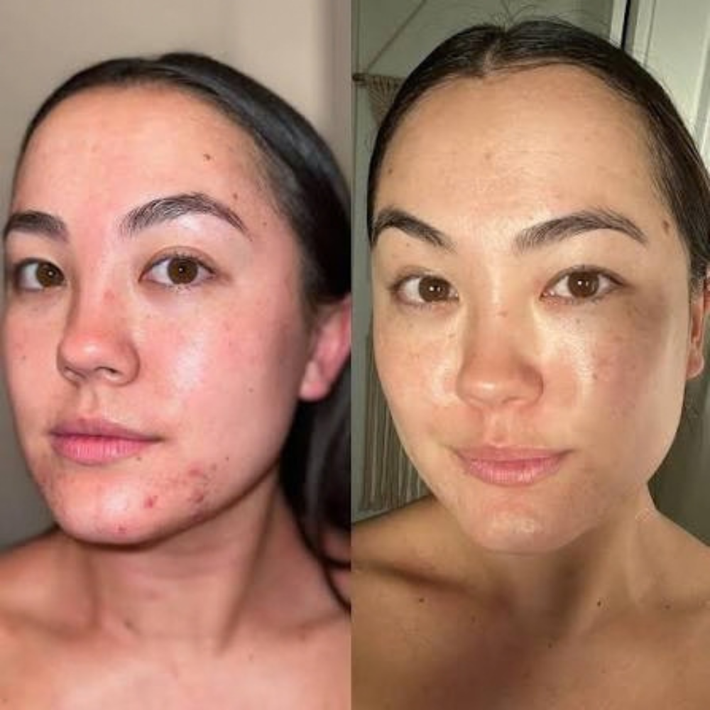 Liposomal Glutathione Skin Glow Strips