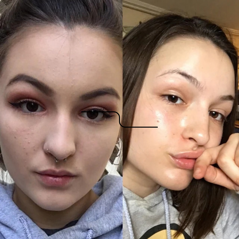 Liposomal Glutathione Skin Glow Strips