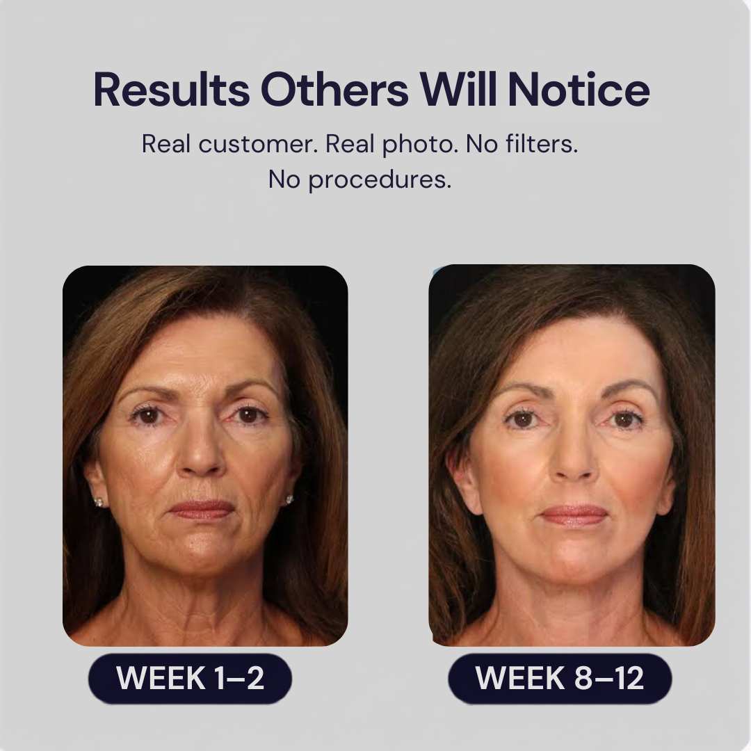 Reliefora™ Collagen Peptide Face Lifting Ampoule