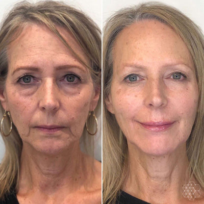Reliefora™ Collagen Peptide Face Lifting Ampoule