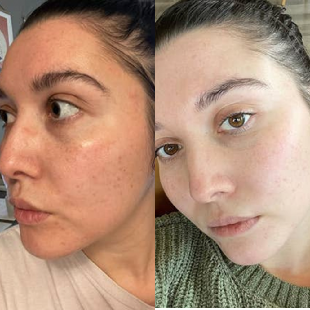 Healthy glowing skin